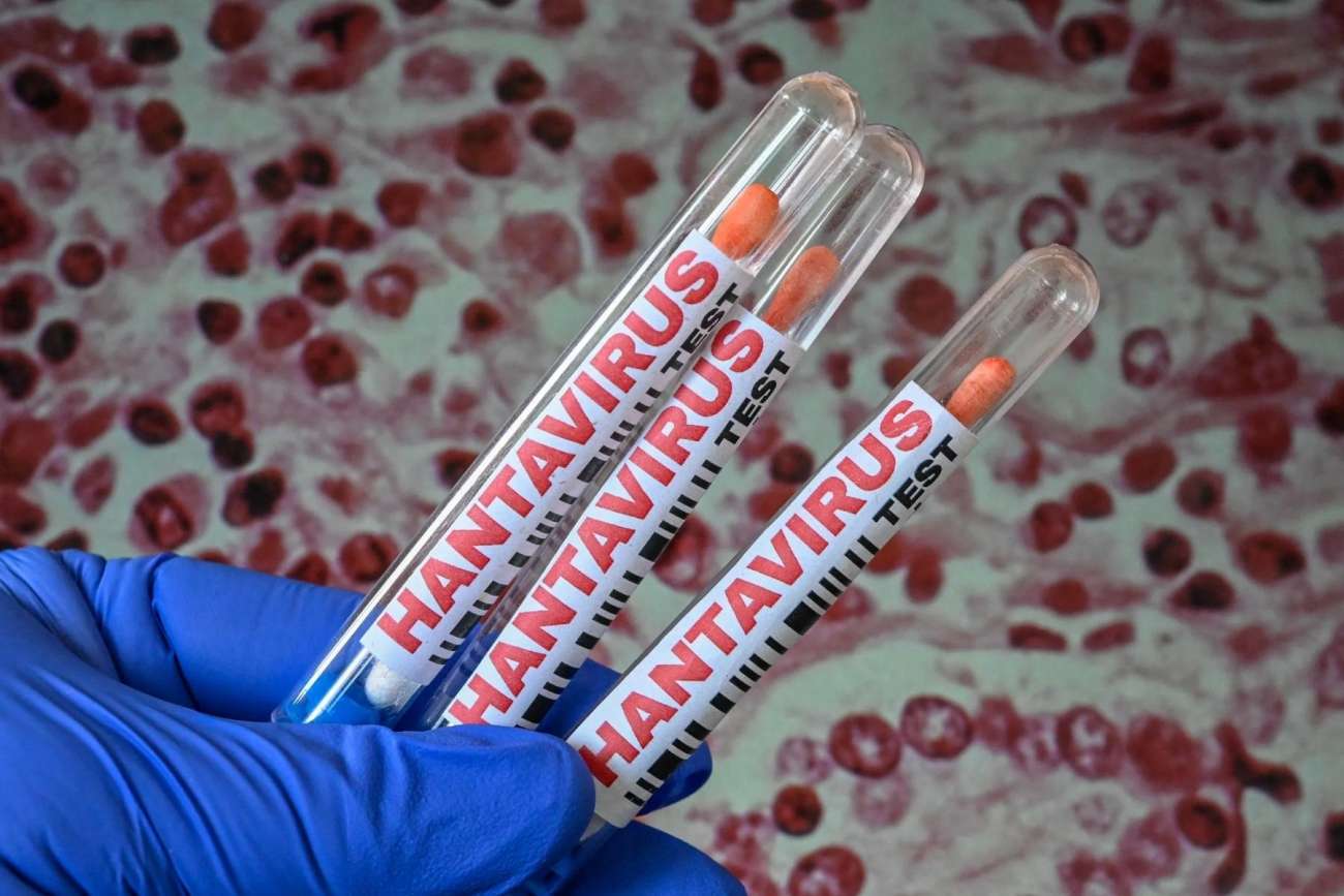 Confirman 10 casos de hantavirus vinculados al brote del crucero MV Hondius