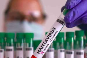 Hantavirus: OMS confirma 12 contagios vinculados al crucero MV Hondius